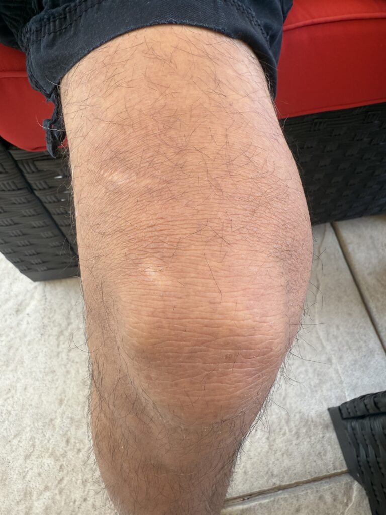 Knee-2 copy